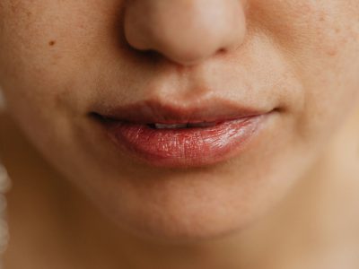 Fast Recovery from Cold Sore Outbreaks: The Power of Aciclovir Tablets