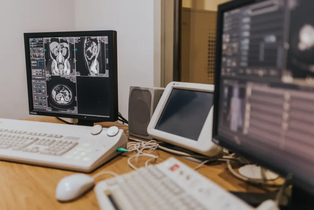 using AI for cancer